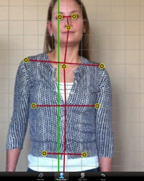 Posture Screening Software-SCJ Article
